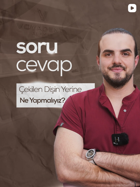 Soru Cevap