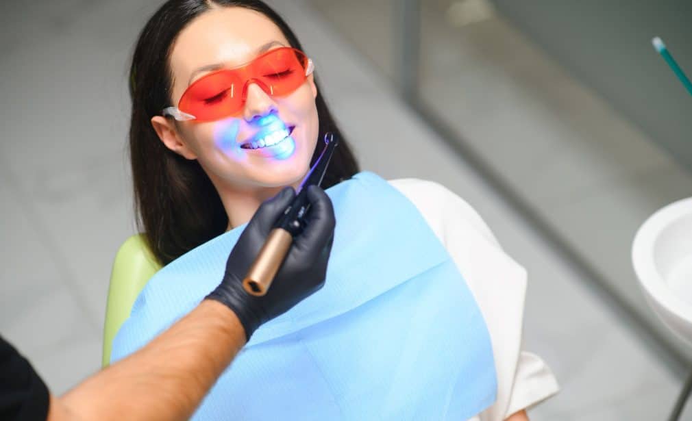 Diş Beyazlatma (Bleaching)