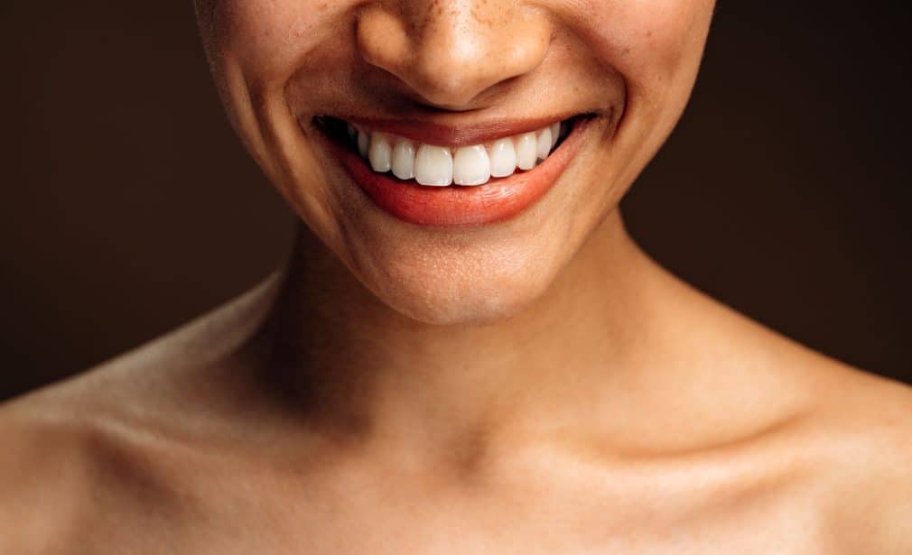 Gülüş Tasarımı (Hollywood Smile, Smile Design)