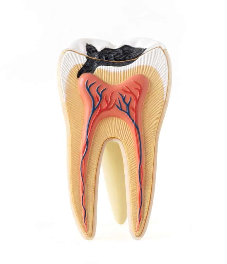 voyadent endodonti kanal tedavisi